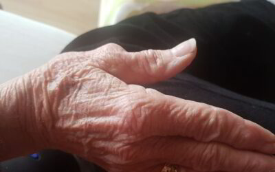 Is Arthritis Really Scary?