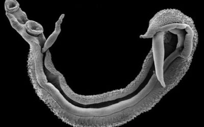 Parasite Cleansing