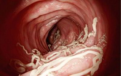 Know more about your resident Parasites